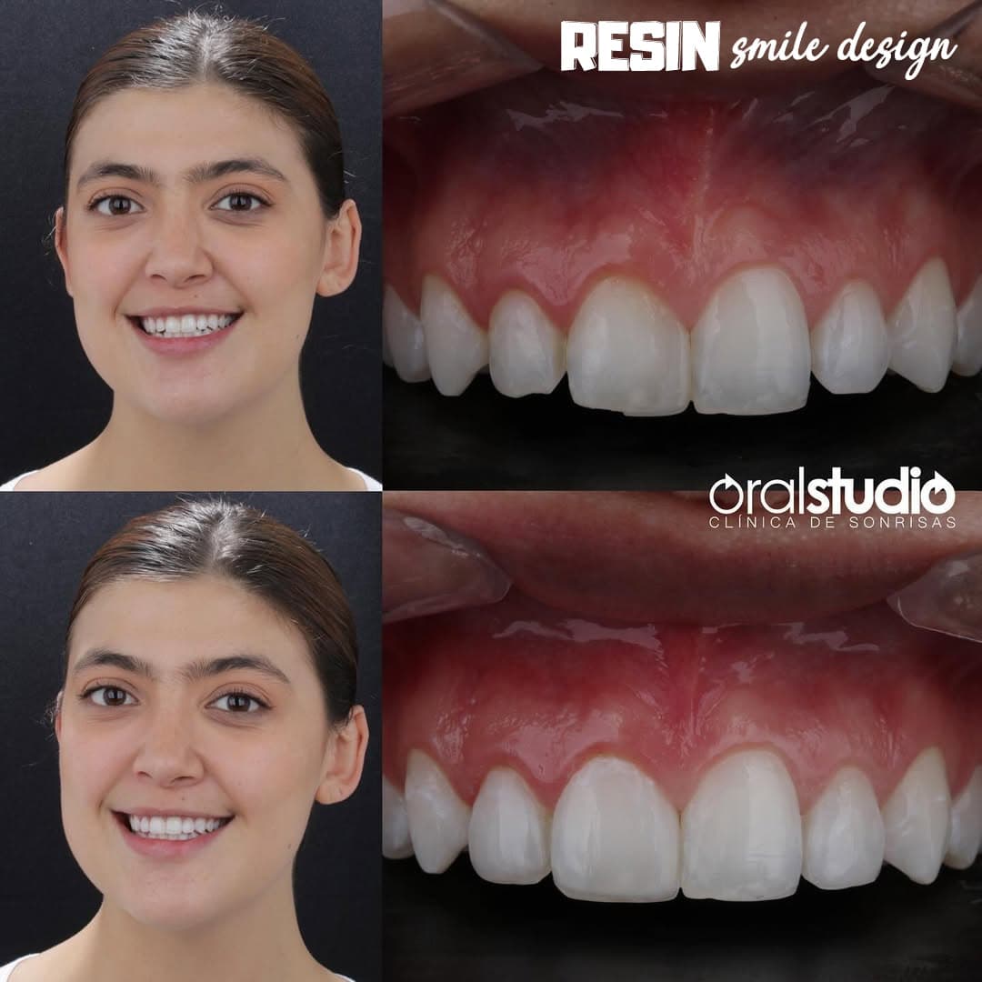 Smile Makeover Medellín photo 2